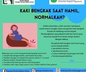 Kaki Bengkak Saat Hamil, Normalkah?